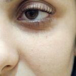 Eyelash-lifting