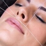 Upper-lip-threading